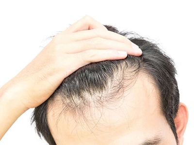 Заболевания кожи головы: причины, симптомы, лечение