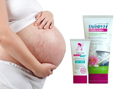 Как избежать растяжек при беременности?