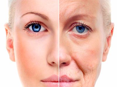 Фотостарение кожи – признаки, причины, профилактика