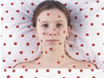 Червоні крапки на шкірі - що означають і як позбутися
