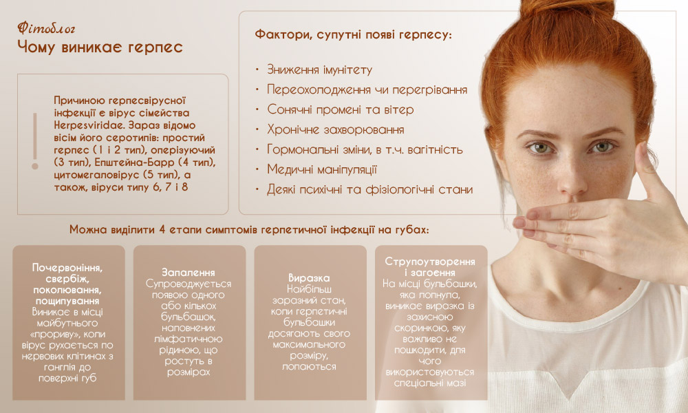 Чому виникає герпес