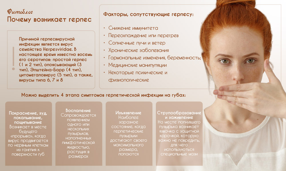 Почему возникает герпес