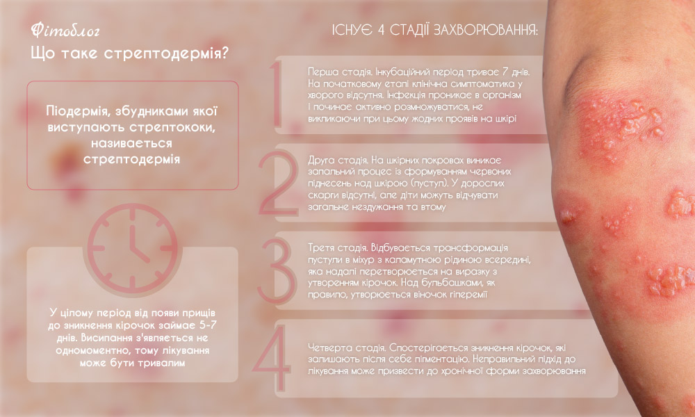 Що таке Стрептодермія?
