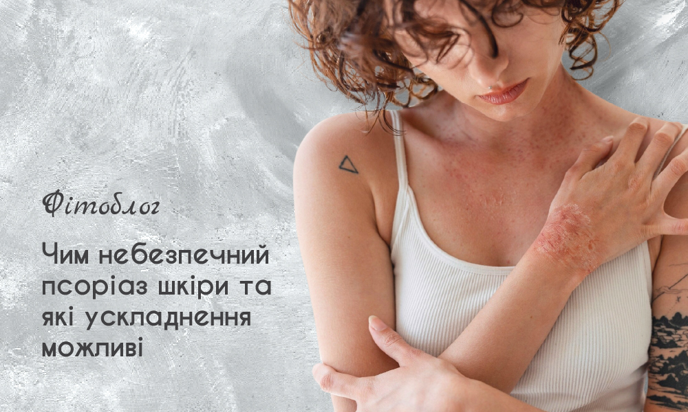 Чим небезпечний псоріаз шкіри та які можливі ускладнення