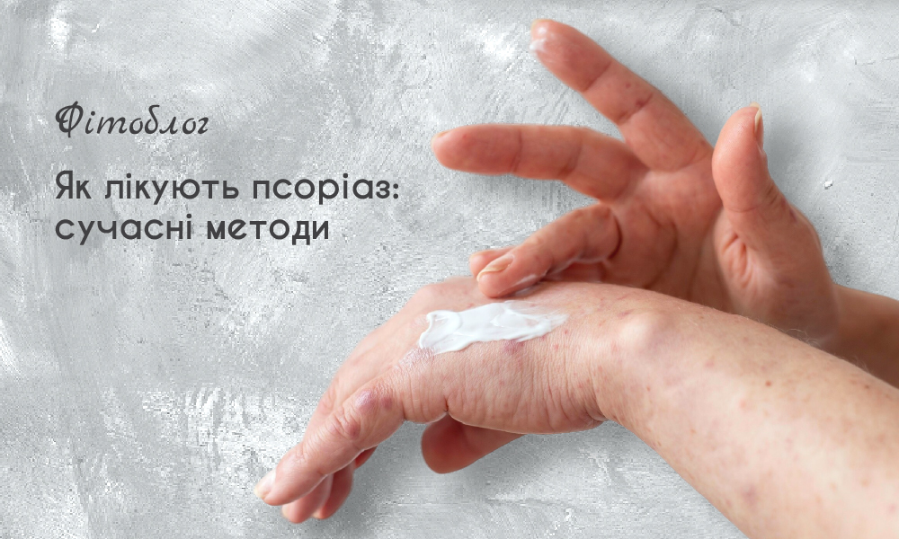 Як лікують псоріаз: сучасні методи