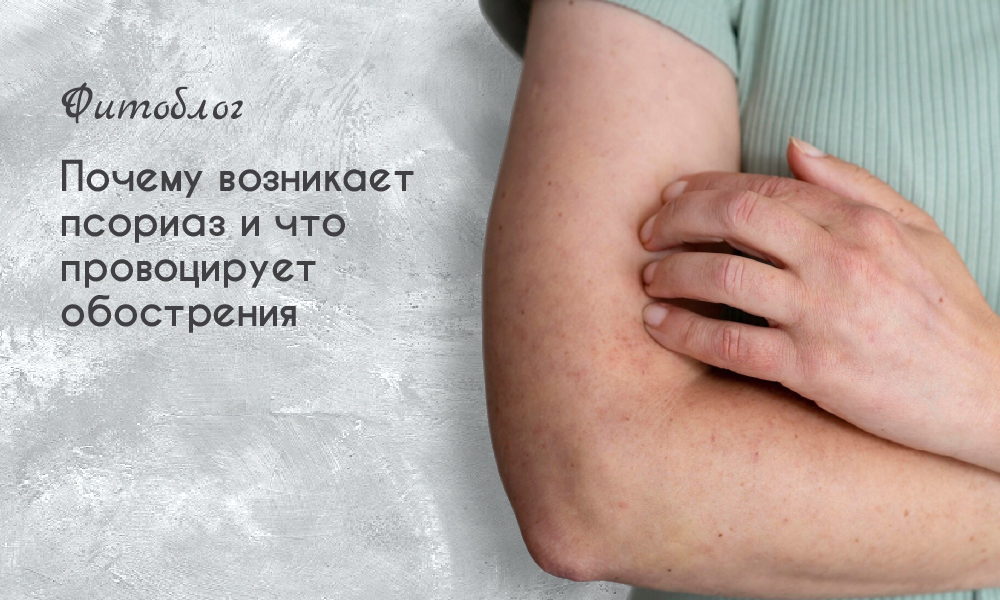 Почему возникает псориаз и что провоцирует обострения
