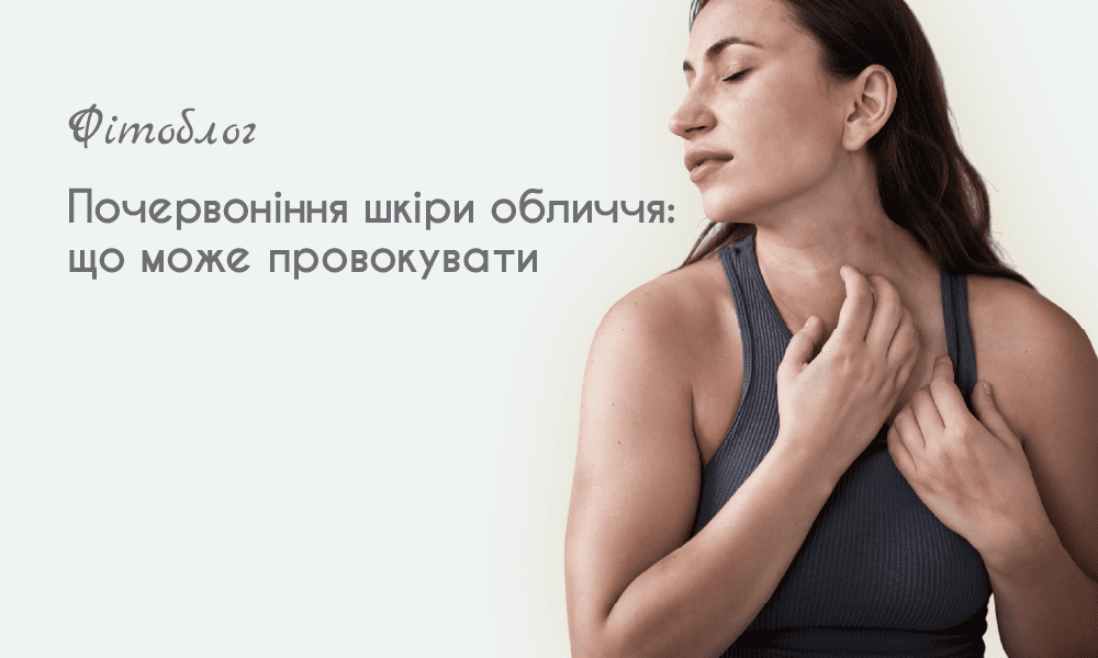 Почервоніння шкіри обличчя: що може провокувати