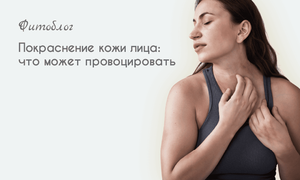 Покраснение кожи лица: что может провоцировать
