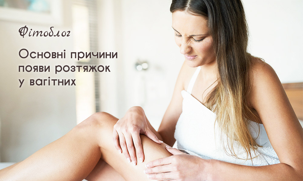 Основні причини появи розтяжок у вагітних