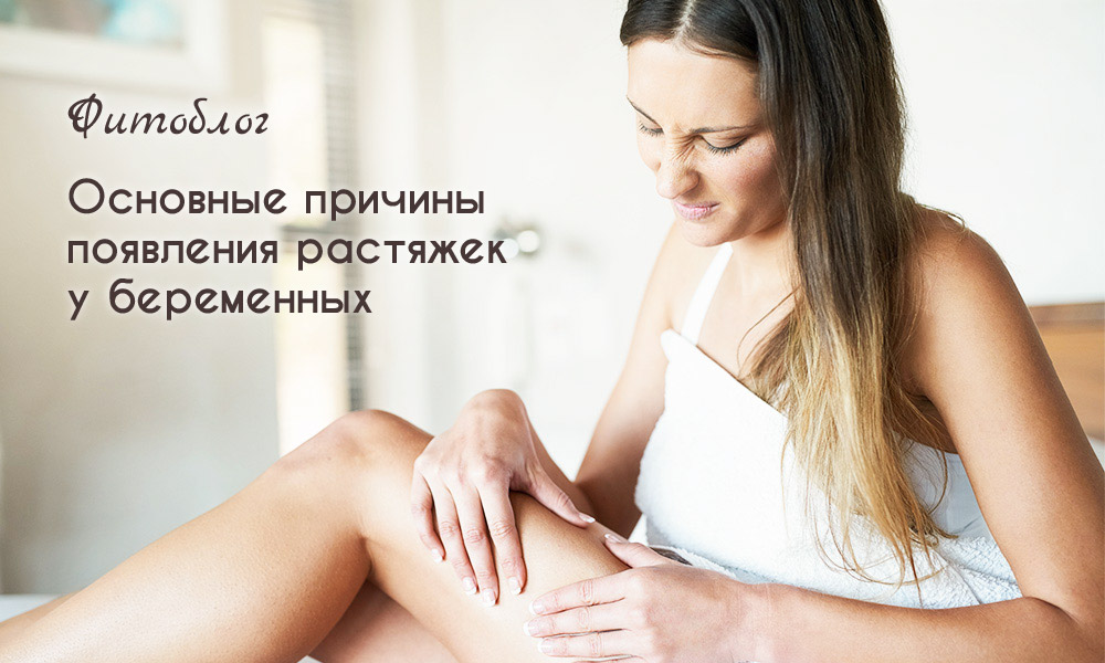 Основные причины появления растяжек у беременных