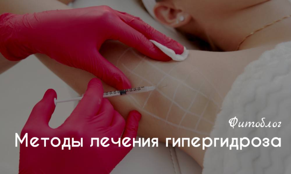 Методы лечения гипергидроза