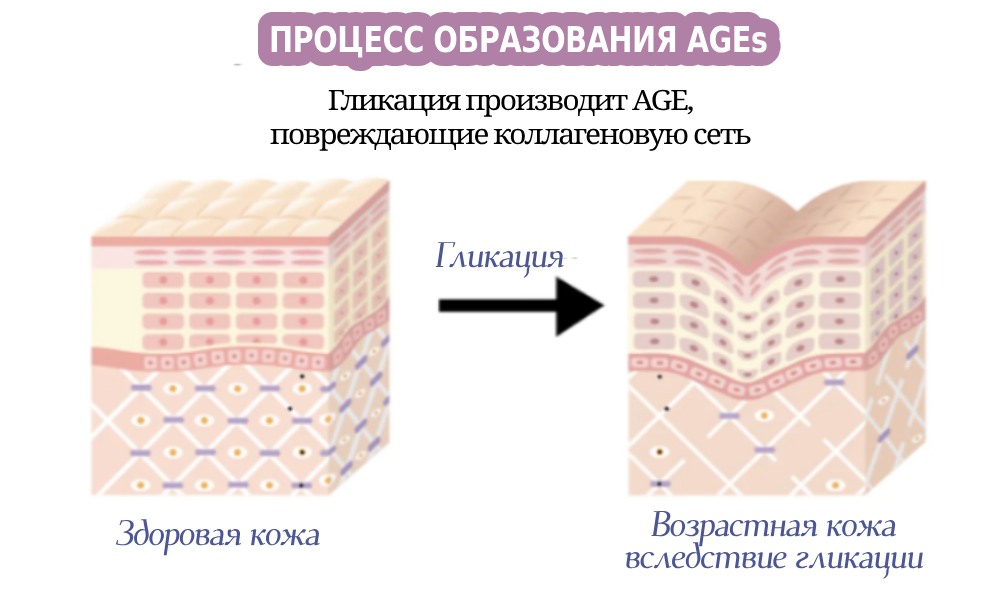 Anti-Glycation Support: противодействие AGE для здорового клеточного старения