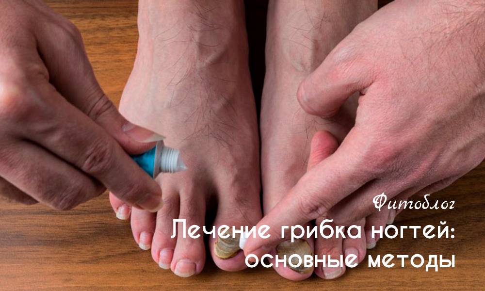 Лечение грибка ногтей: основные методы