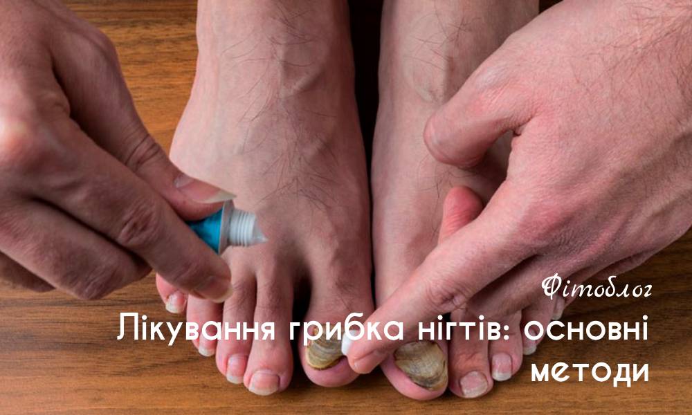 Лікування грибка нігтів: основні методи