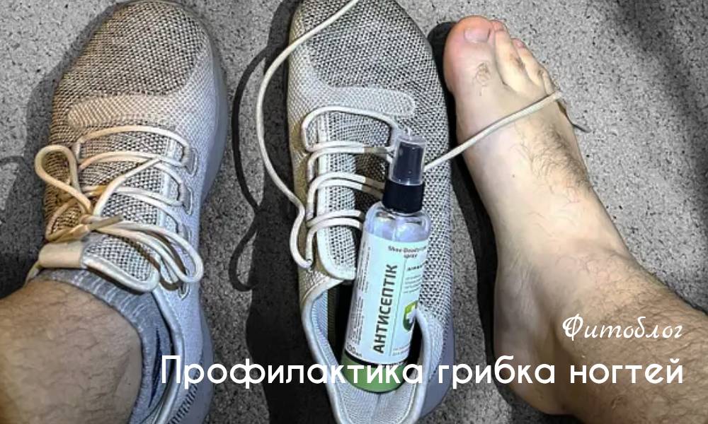 Народные средства от грибка ногтей