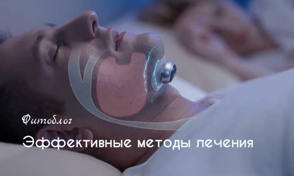 Эффективные методы лечения храпа