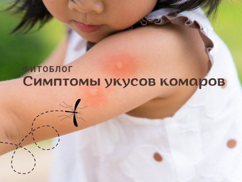 Симптомы укусов комаров