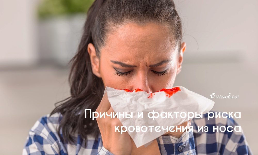 Сгустки крови из носа: причины