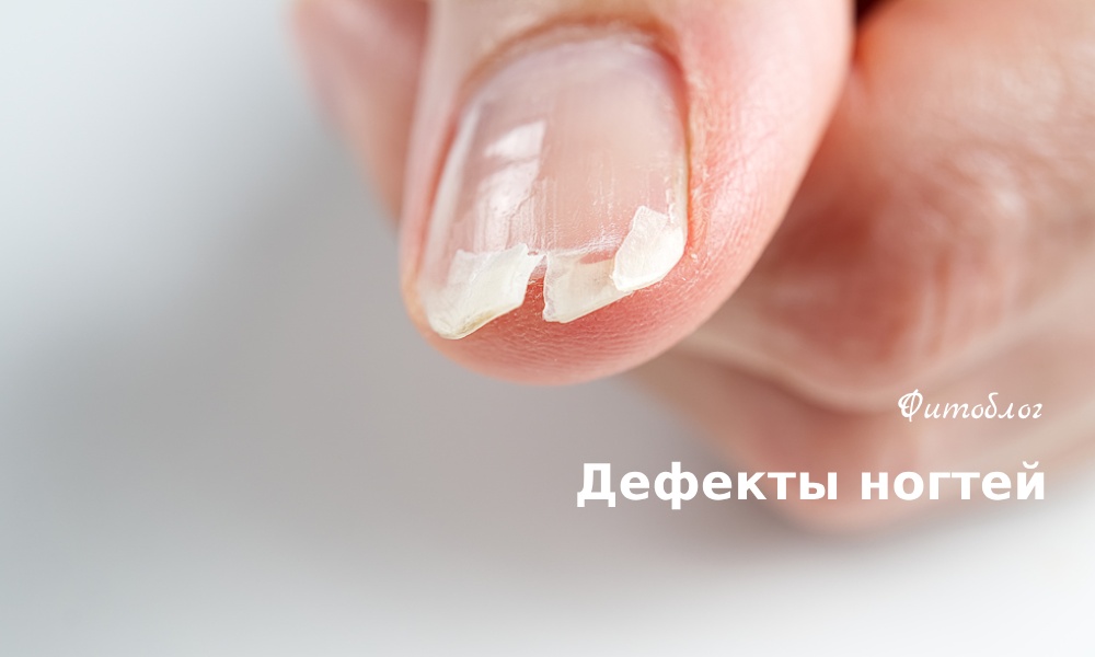 Внешние причины ухудшения вида ногтей