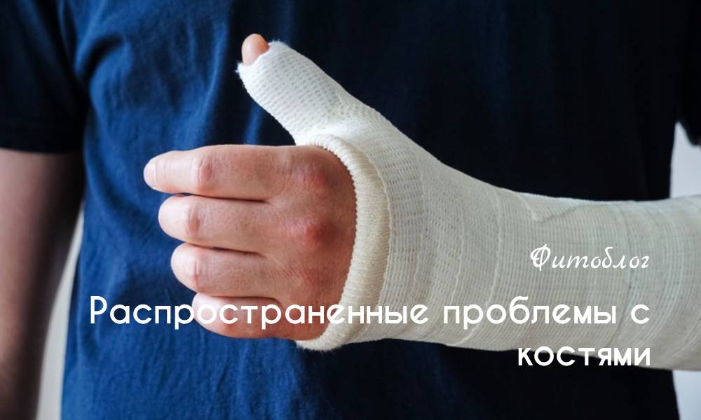 Распространенные проблемы с костями 
