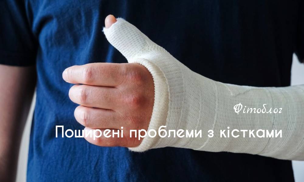Поширені проблеми з кістками