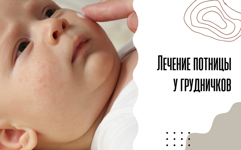 Потница у новорожденных: симптомы и лечение
