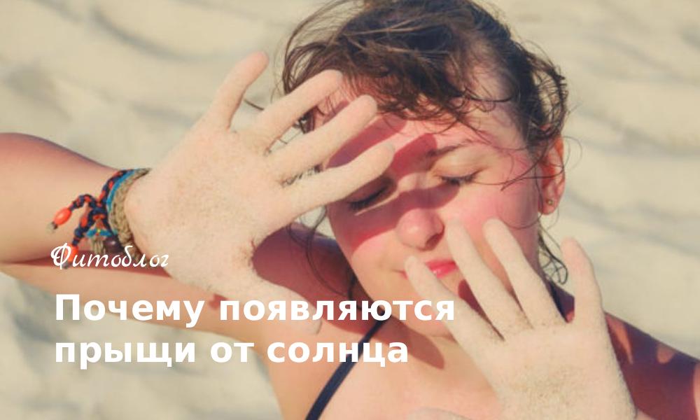 Почему появляются прыщи от солнца
