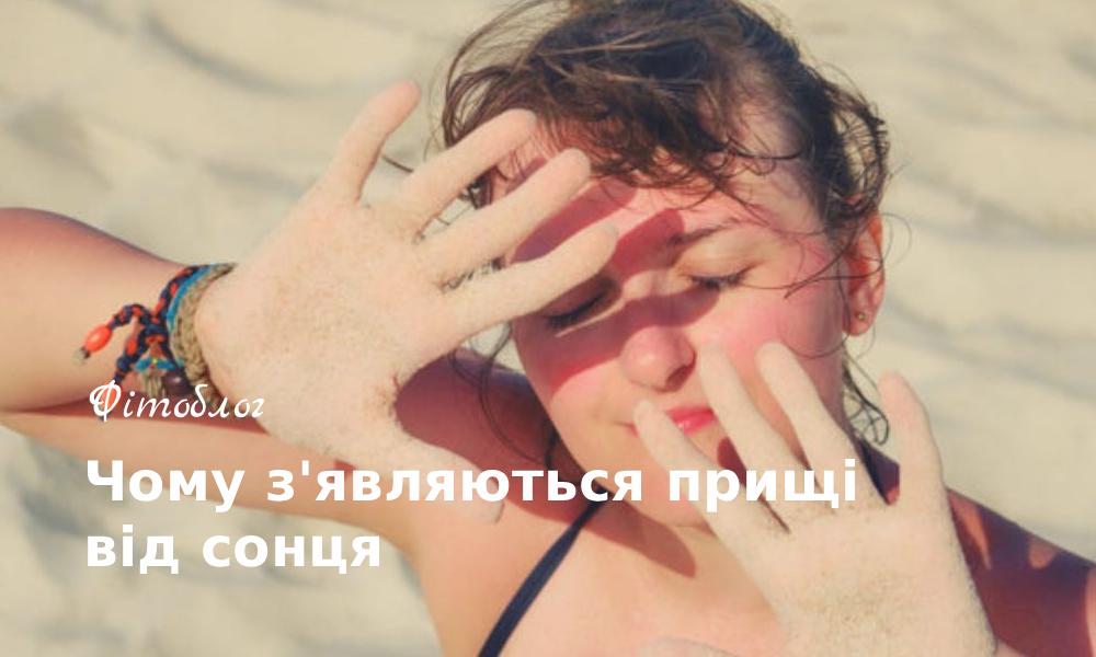 Чому з'являються прищі від сонця