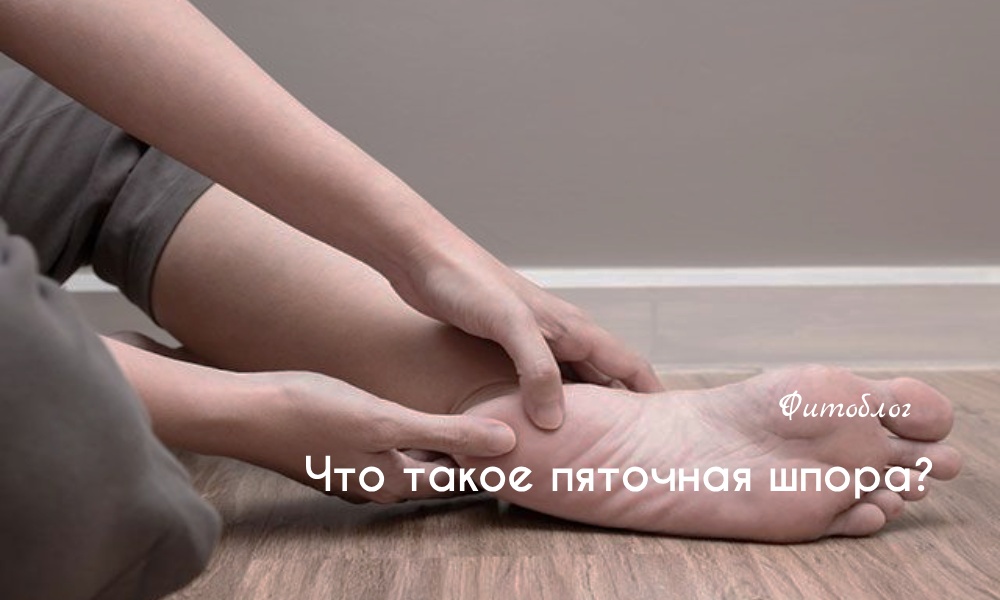 Пяточная шпора - симптомы и лечение в домашних условиях - лечение шпоры на пятках - Блог webmaster-korolev.ru