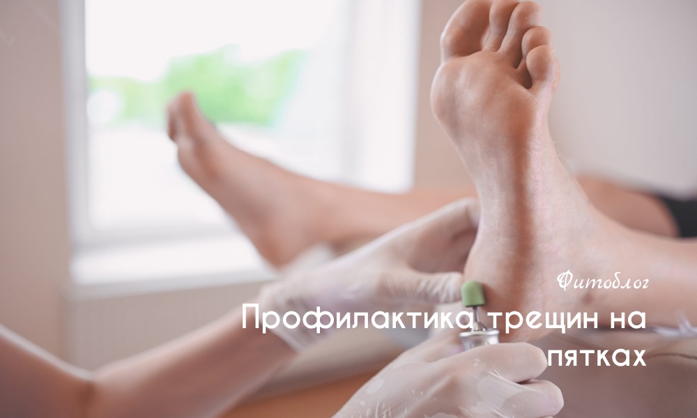 Лечение трещин между пальцами ног | Центр подологии и остеопатии Татьяны Красюк